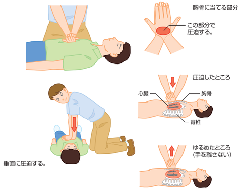 神戸市：AEDを使用した心肺蘇生法の手順
