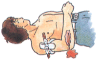 腕からの出血