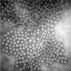 ノロウイルス電子顕微鏡写真