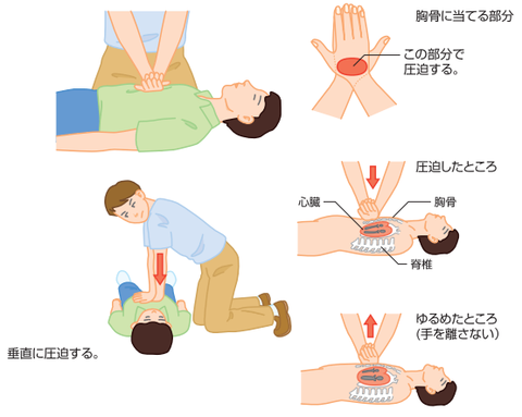 神戸市 Aedを使用した心肺蘇生法の手順
