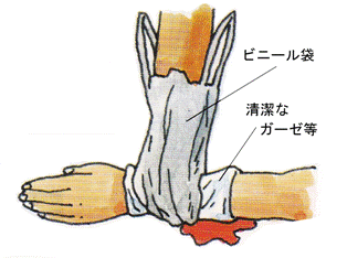 神戸市 応急手当の方法 止血法