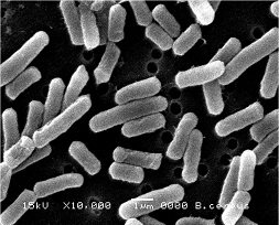 セレウス菌電子顕微鏡写真