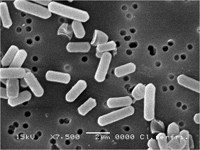 ウェルシュ菌電子顕微鏡写真